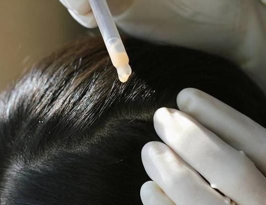 10%硫磺软膏,10%苯甲酸苄酯搽剂,1�t霜剂,复方敌百虫霜剂,10%优力肤