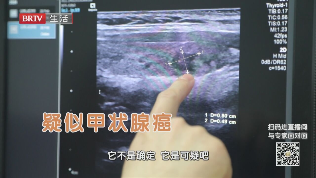 《全民健康学院》20240312管好甲状腺结节 莫让“懒癌”变勤快 《全民健康学院》20240312管好甲状腺结节 莫让“懒癌”变勤快