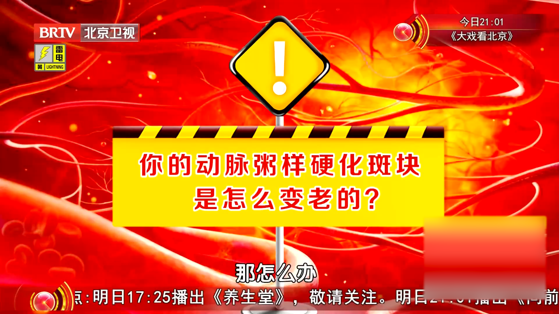 你知道动脉粥样硬化斑块，是怎么“变老”的吗？