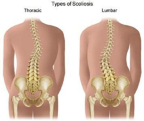 骨盆歪斜、腰椎错位!腰痛、腿痛的原因终于找