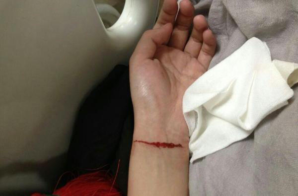 网曝王倩(化名)用刀刺中自己胸口,手腕自杀的照片