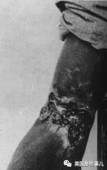 为了研究梅毒获得数据,他们眼睁睁看着几百个