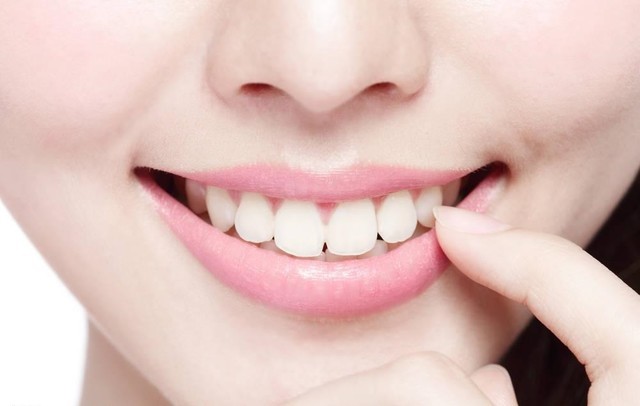 好习惯不等于好牙齿 科学洁齿还需好工具