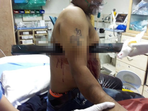 男子驾车打瞌睡 被铁柱横穿躯干 男子驾车打瞌睡 被铁柱横穿躯干