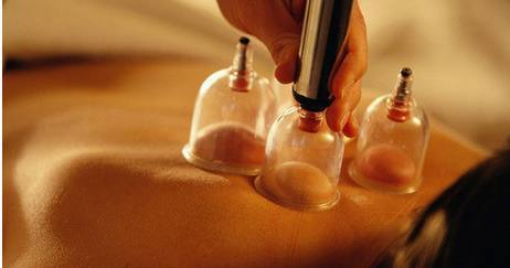 拔罐减肥也是要看时间的,你挑对时间了吗