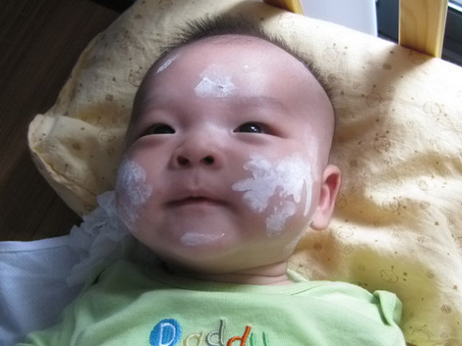 新生儿湿疹可以用炉甘石洗剂吗? 新生儿湿疹可以用炉甘石洗剂吗?