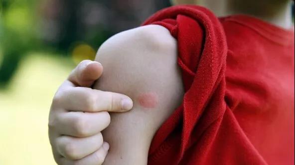 浙江一姑娘相亲归来,撩起裙子吓到崩溃:腿上几