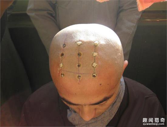 和尚头上为什么有点?一般都是几个? 和尚头上为什么有点?一般都是几个?