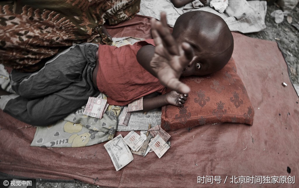 令人揪心!这里的儿童枯瘦如柴 在生死线上挣扎谋生