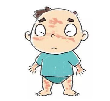 皮肤一抓就红,一抓就痒?小心荨麻疹侵扰!