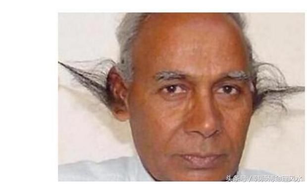 此处有毛的人,不可小看,必定是人中龙凤,福气多