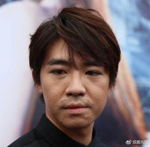 命运让人不幸,惨遭毁容后胡歌俞灏明逆境成长,陈志朋却成了笑柄