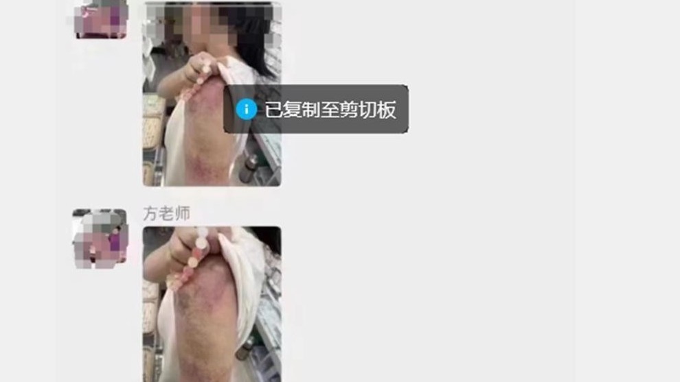 热评|教师体罚学生反获其他家长感谢？怎样的教育配得上家长的感恩