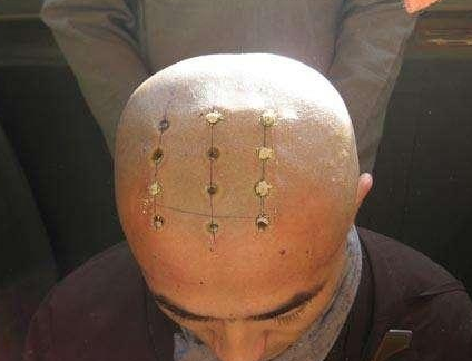 古代和尚为什么要烧几个戒疤? 现在为什么都没有了? 古代和尚为什么要烧几个戒疤? 现在为什么都没有了?