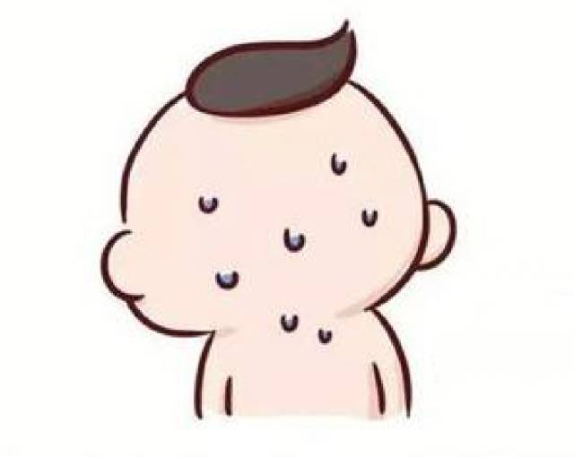宝宝睡觉头上出汗多是怎么回事?如何护理多汗