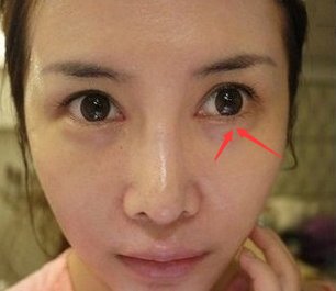 中国药店一便宜药膏一路走红,祛斑淡纹,外国