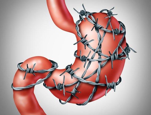 规律,造成很多人患上了胃病,有些人胃不好已经严重的影响了正常的生活