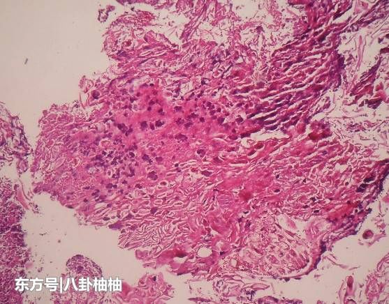 60岁男子每天吃5包槟榔,不听家人劝,之后却痛