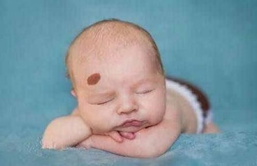 宝宝身上最有福气的4个胎记,你家宝宝身上有没