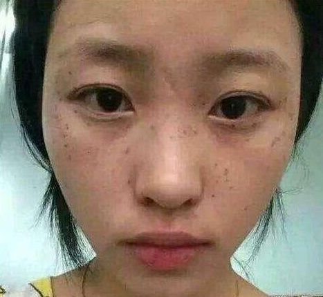 开塞露遇到牙膏,每天晚上抹脸,3天斑点扫光光