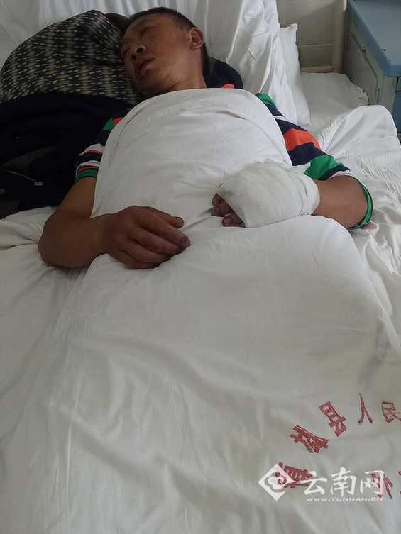 云南男子被围殴打断肋骨 家属：打人者是镇政府的人