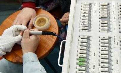 女友和男友亲吻后, 全身起红斑, 医生检查结果,