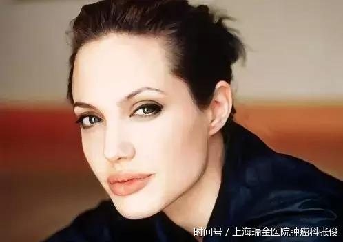 好莱坞女星安吉丽娜朱莉掀起基因检测狂潮,癌