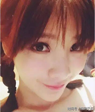 法令纹太深怎么办?这个做法会让你越填越深