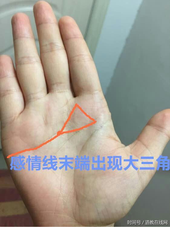 小心,女人“这里”出现了大三角,你老公被人惦记了 小心,女人“这里”出现了大三角,你老公被人惦记了