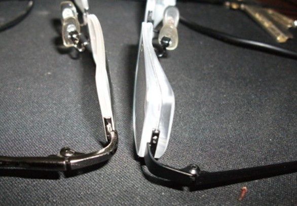 800度近视恢复真实案例