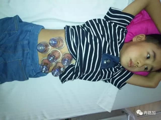 冉路加:磁罐疗法如何治好7岁儿童积食呕吐