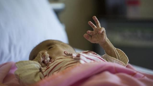 婴儿患怪病,出生半年多体重丝毫没有生长,父母难过不已!