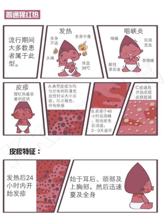 山东进入猩红热高发季节 怎样预防看这里(图)