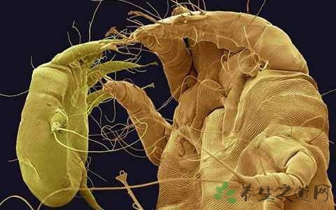 治疗疥疮结节有什么特效药