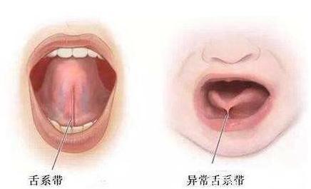 5岁孩子不会说话,妈妈带去医院检查,医生看一