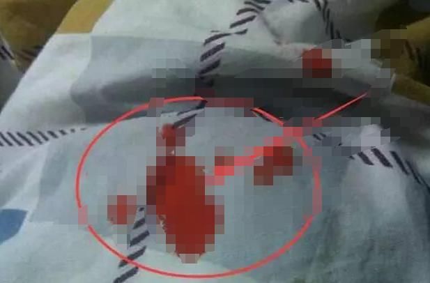 生完宝宝六个月忽然大出血,检查结果让医生哭