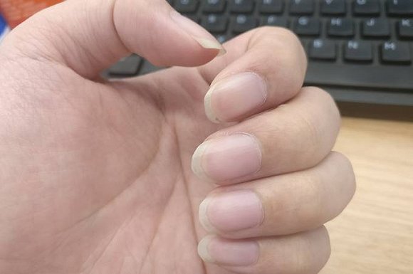 怕伤到手指?试试这根会震动的指甲刀