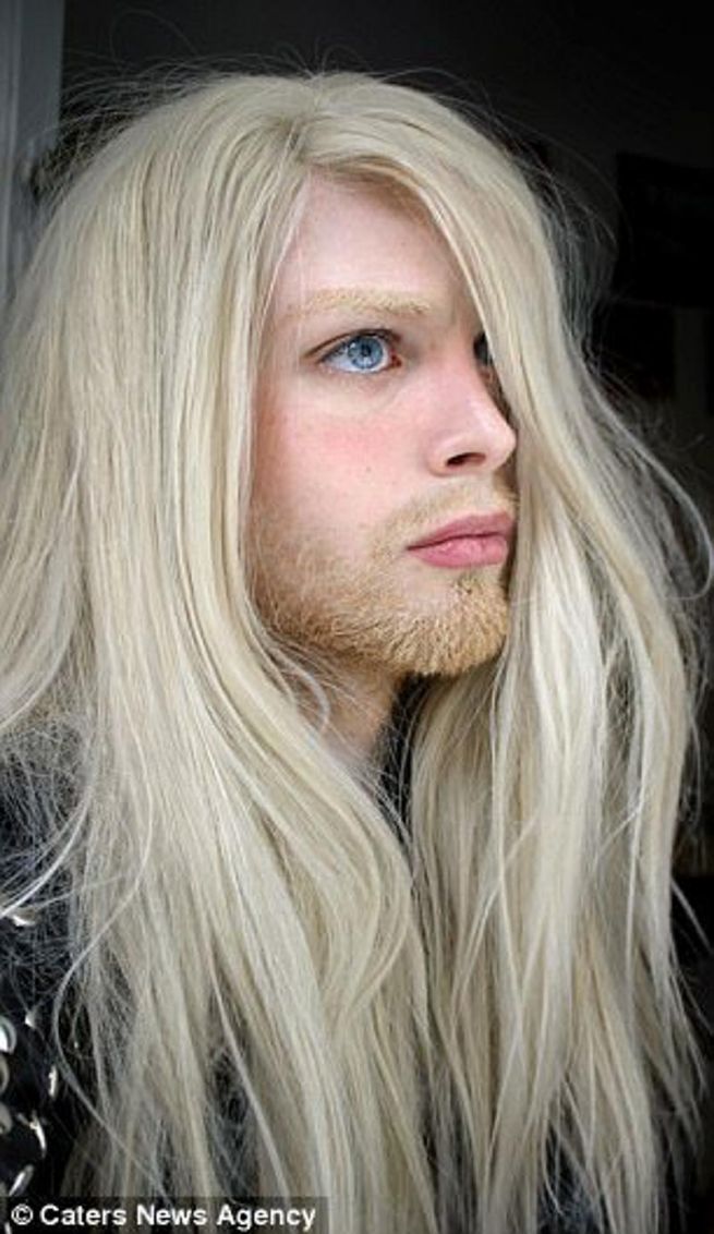 男子执着于变成"精灵"花22万整容 原因让人心酸