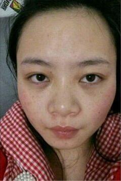 阿司匹林兑上它可以祛斑美白,村里的大妈都纷