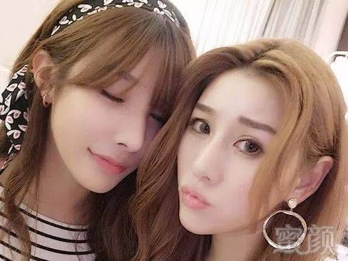 都说整容也要看底子,底子到底是什么?