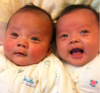 宝宝脸上长湿疹怎么办?宝宝湿疹最佳治疗方法