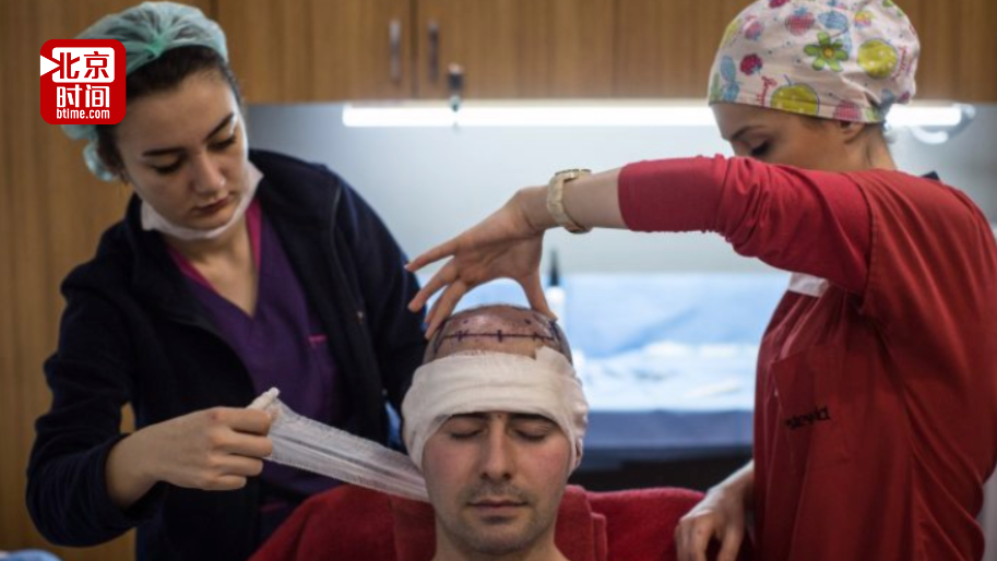 守卫发际线!印度富商一次要求植发9000根 结果才3700根就因过敏身亡 守卫发际线!印度富商一次要求植发9000根 结果才3700根就因过敏身亡