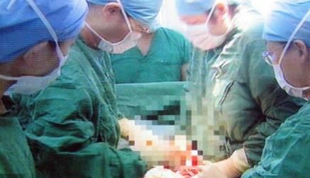 女人生孩子到底是有多痛苦?看完这些之后,就会