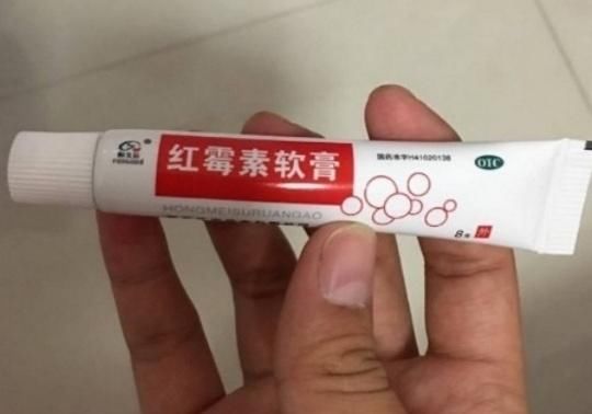 牙膏加醋,睡前抹一抹,一夜斑点全消,透白嫩无瑕