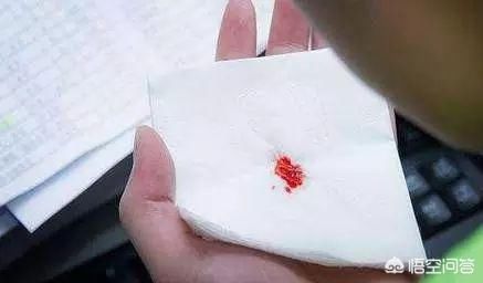 周围有人肺癌晚期仍然没有任何症状,最后发现