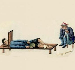 宫刑,一种割除男子生殖器官和使女子丧失生殖机能的肉刑刑罚,男子宫刑