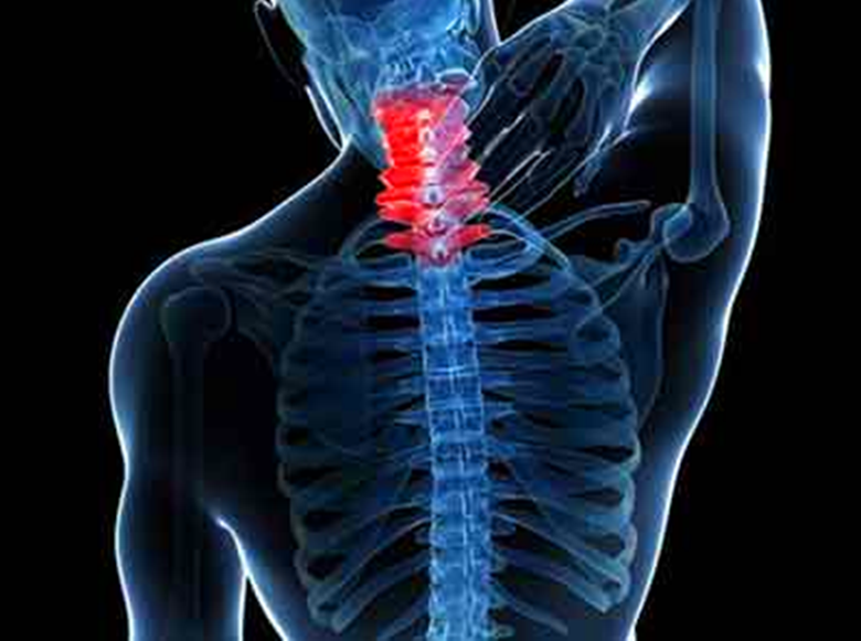 颈椎病容易导致高血压,治疗颈椎病的几个好方