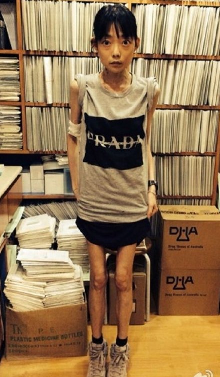 10位娱乐圈女明星最瘦时候不到80斤,鲁豫郑爽