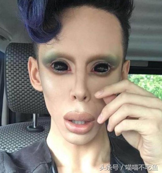 美国小伙从17岁开始整容上瘾,总共整容110次,如今像外星人!