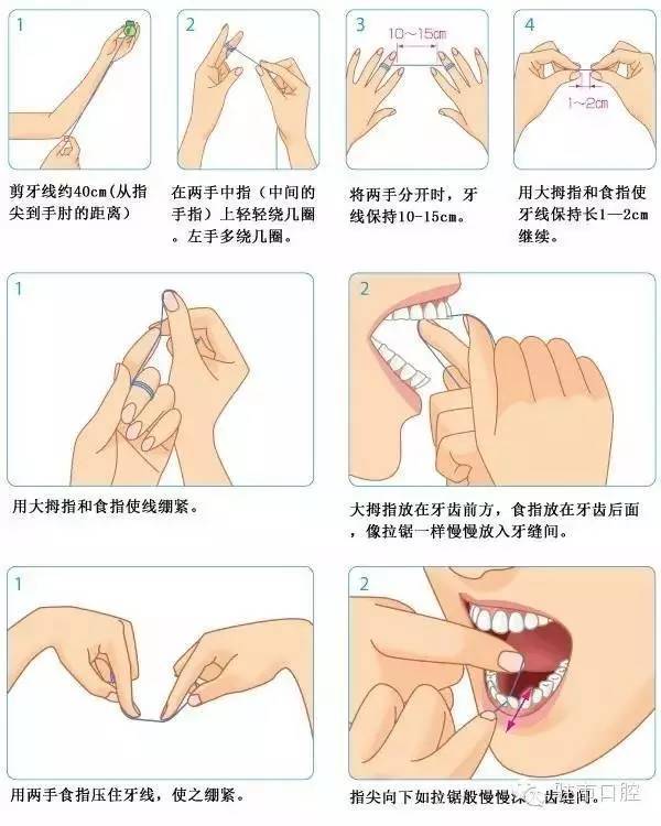 牙线怎么用? 正确使用牙线的6个步骤